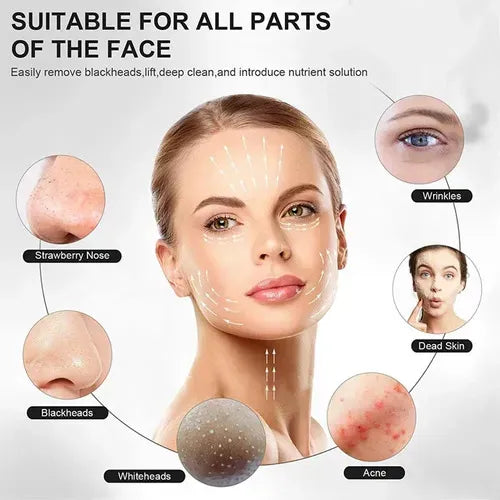 Deep Cleansing Blackhead Remover