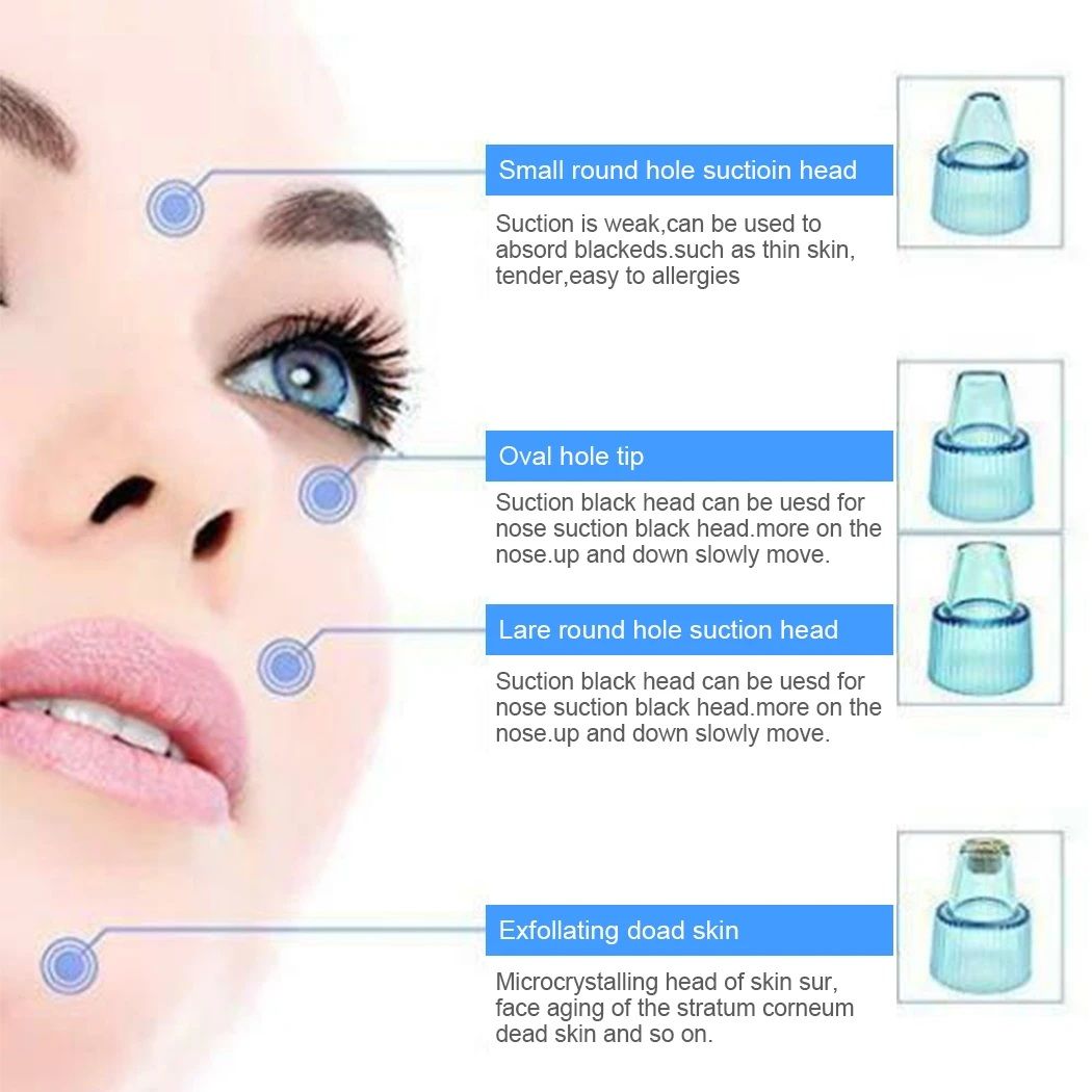 Blackhead Removal Machine – 4-in-1 Derma Suction Blackhead Remover