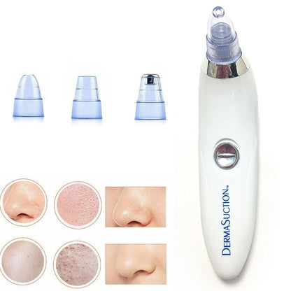 Blackhead Removal Machine – 4-in-1 Derma Suction Blackhead Remover